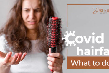 COVID Hair Fall