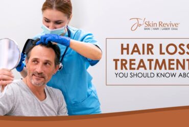 Hair Loss Treatments